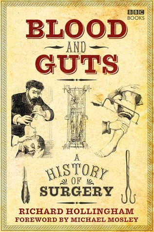 Blood and Guts: A History of Surgery